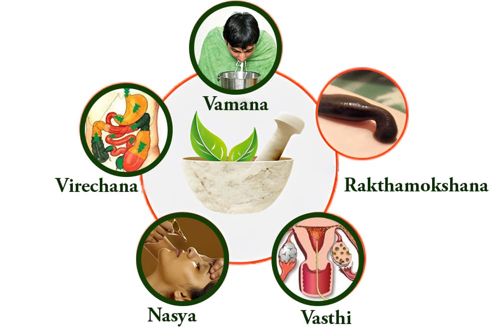 panchakarma image